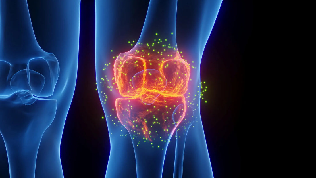 Angiographic image showing embolic particles occluding genicular arteries around the knee joint