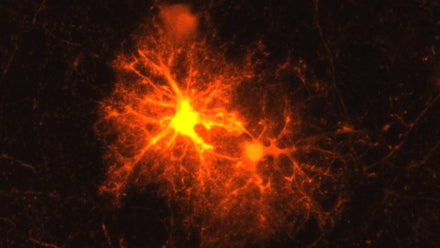 Brain cells with myelin insulation