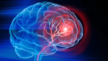Microscopic image of brain blood vessels showing APOE4‑induced leakage