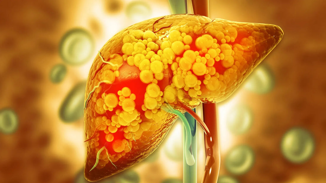 This protective enzyme could help stop fatty liver disease from getting worse