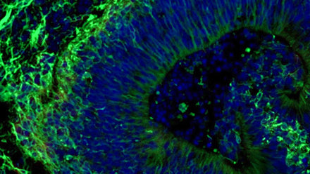 A microscopic image of a brain organoid
