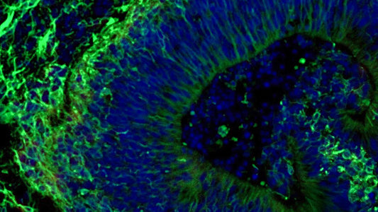 A microscopic image of a brain organoid