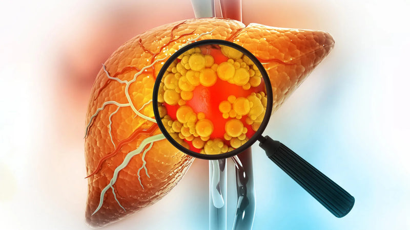 Microscopic image of mouse liver showing fat droplets after high‑fructose feeding