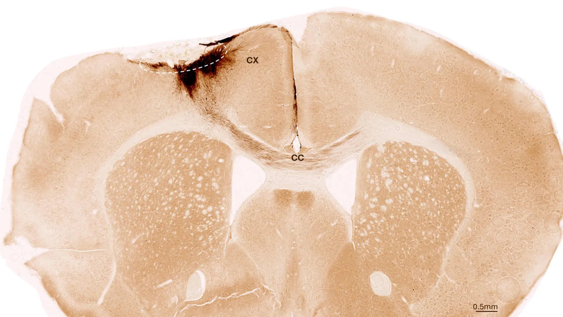 Microscopic image of transplanted stem cells differentiating into neurons within a mouse brain after stroke.