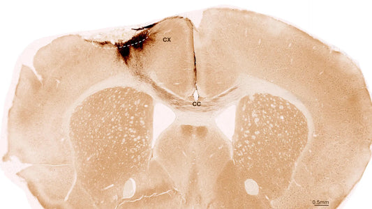 Microscopic image of transplanted stem cells differentiating into neurons within a mouse brain after stroke.