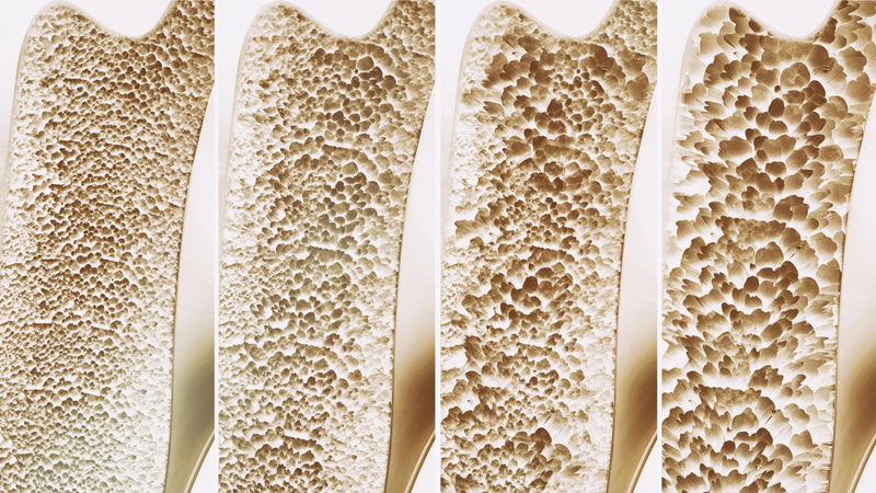 Micro-CT image showing increased trabecular bone density in mice treated with AP503