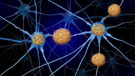 Microscopic image of mouse hippocampus showing preserved gray matter after immune‑blocking treatment