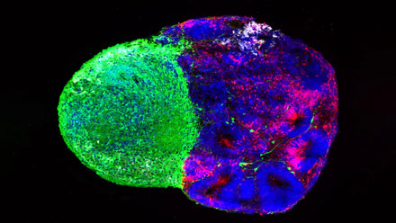 High‑resolution microscopy image of radial glial cells extending processes in a developing human cortex