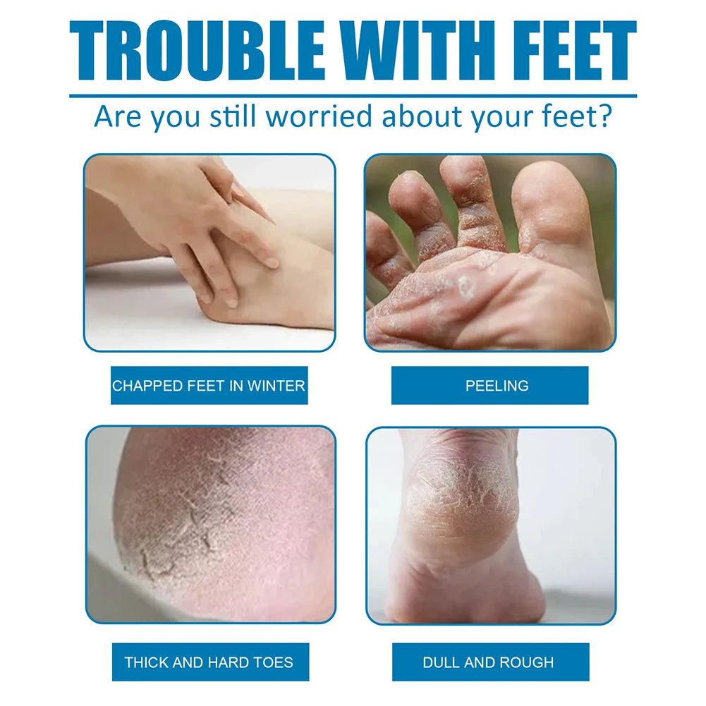 1 Pair Exfoliating Moisture Feet Mask Pedicure Cuticles Peel Off Dead Skin Remover Foot Care by Anti Spier