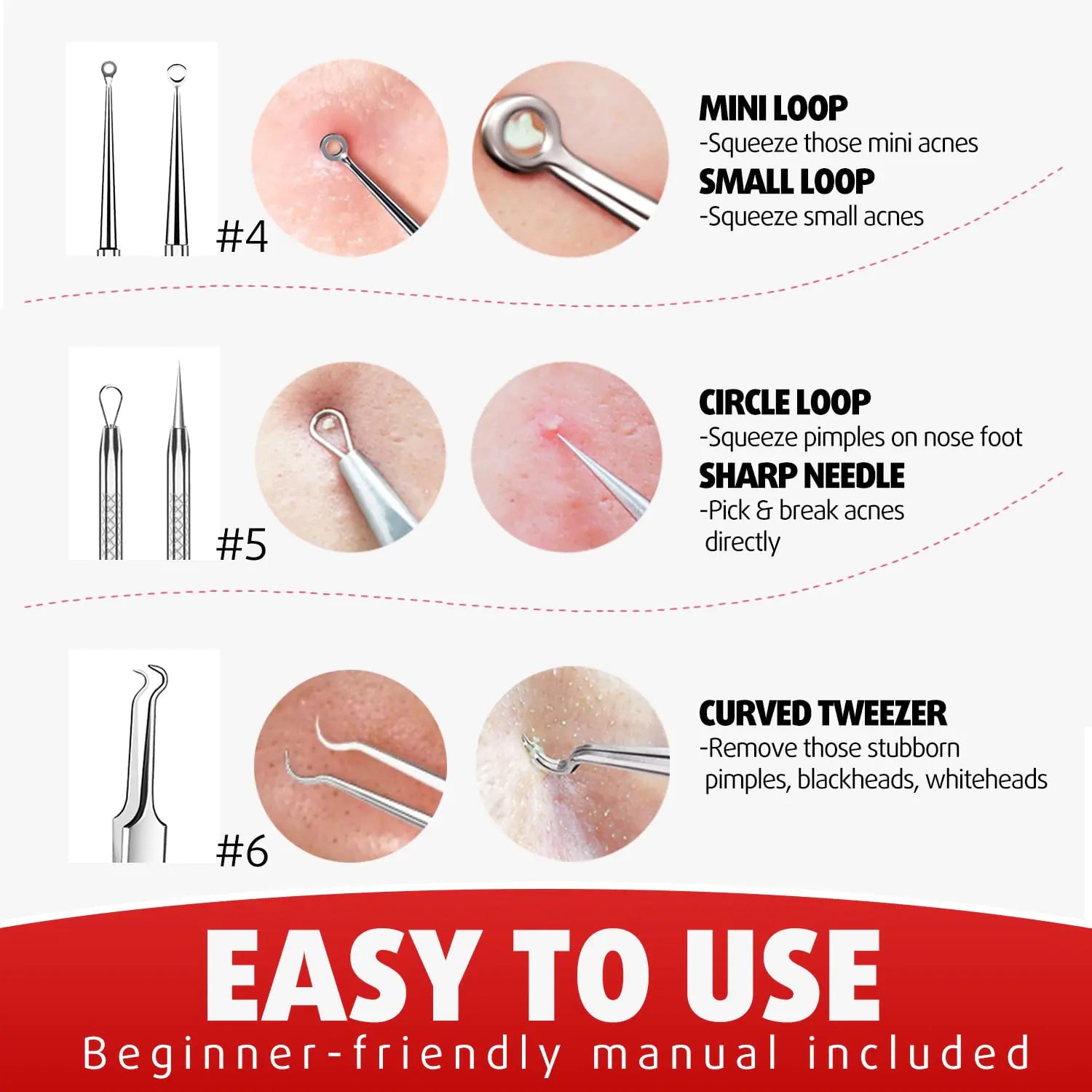 Cbiumpro Blackhead Remover Tools, Pimple Popper Tool Kit, Blackhead Extractor Tool, Zit Popper Tool, Professional Pimple Extractor Tool for Blackhead, Acne, Whitehead, Comedone on Nose - with Case Pimple Popper Tools 6 Pack - Cool Black by Anti Spier