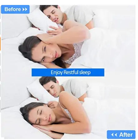 Premium Anti Snoring Device by Anti Spier