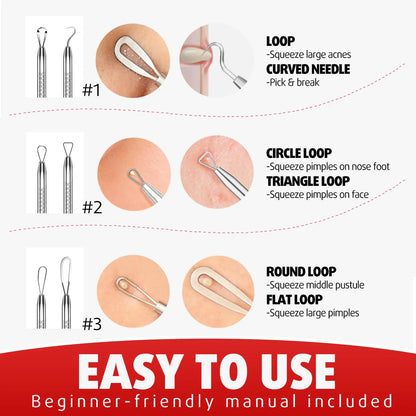 Cbiumpro Blackhead Remover Tools, Pimple Popper Tool Kit, Blackhead Extractor Tool, Zit Popper Tool, Professional Pimple Extractor Tool for Blackhead, Acne, Whitehead, Comedone on Nose - with Case Pimple Popper Tools 6 Pack - Cool Black by Anti Spier