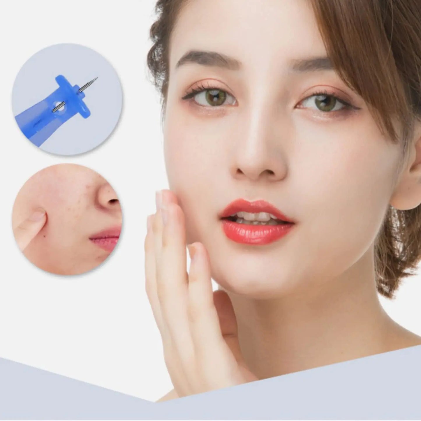 Professional 50pcs Disposable Blackhead and Blemish Remover Tools for Acne, Whitehead, Comedone Removal - Pimple Popper Set for Salon and Home Use by Anti Spier