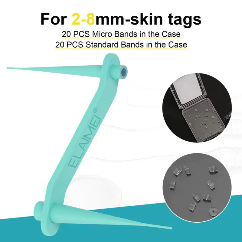 Auto Skin Tag Remover Kit by Anti Spier