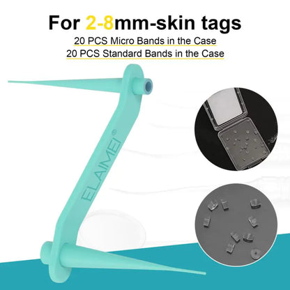 Auto Skin Tag Remover Kit by Anti Spier