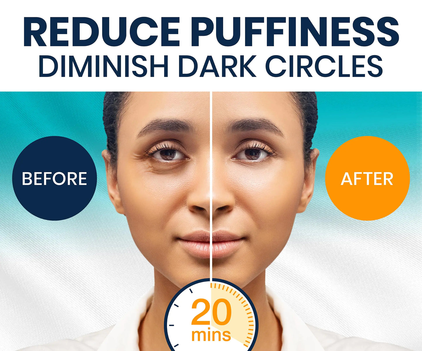 Under Eye Patches for Dark Circles and Puffy Eyes (30 Pairs), Marine Collagen Eye Mask for Puffiness with Vitamin C, Hyaluronic Acid, and Pearl Extract, Eye Gel Pads for Dark Circles and Puffiness 30 Count (Pack of 1) by Anti Spier