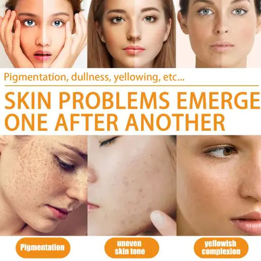 Vitamin C Serums by Anti Spier
