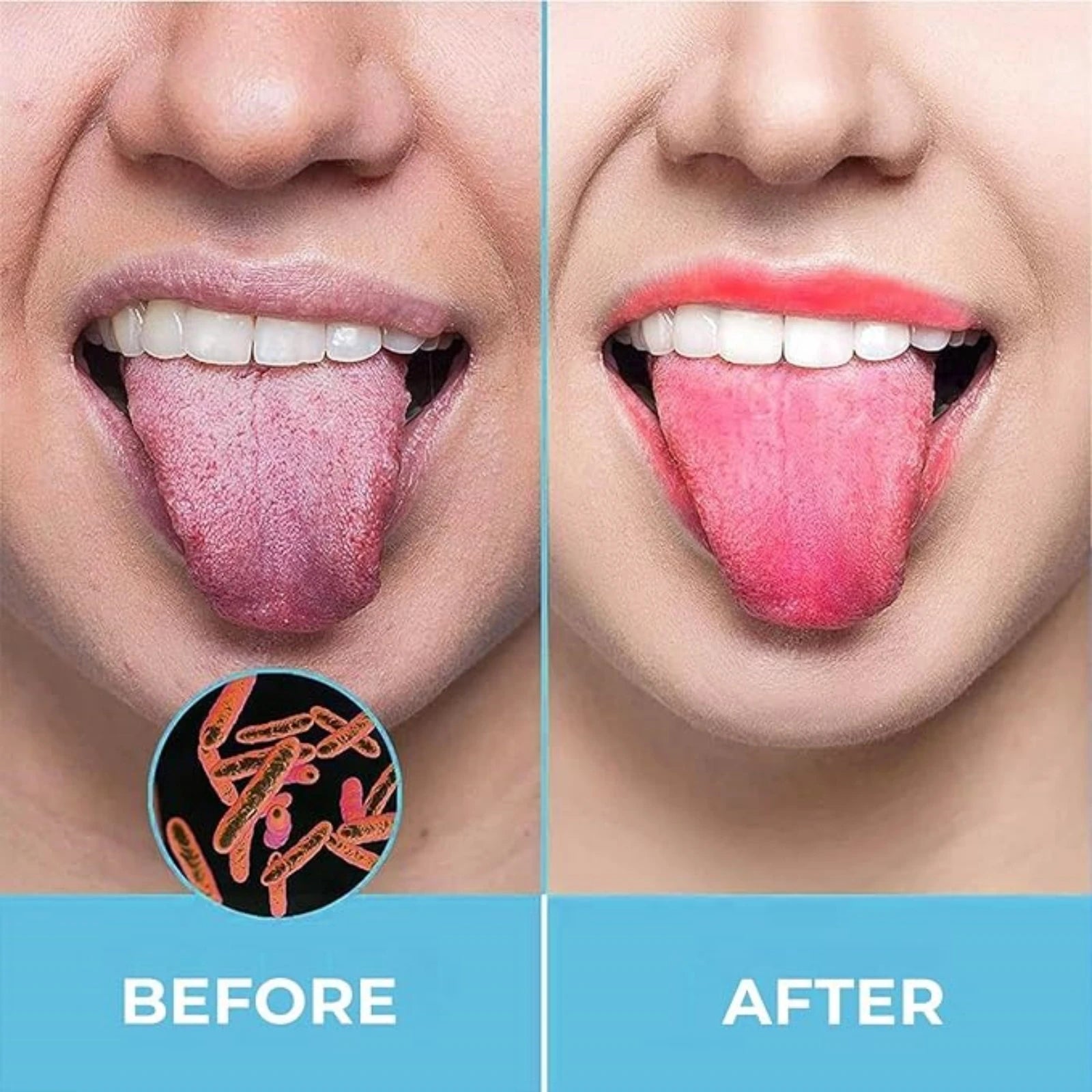 Tongue Cleansing Gel Tongue Coating Removal Kit Removing Thick White Tongue Coating,Balance Flora Freshing Breath Oral Care Tool by Anti Spier