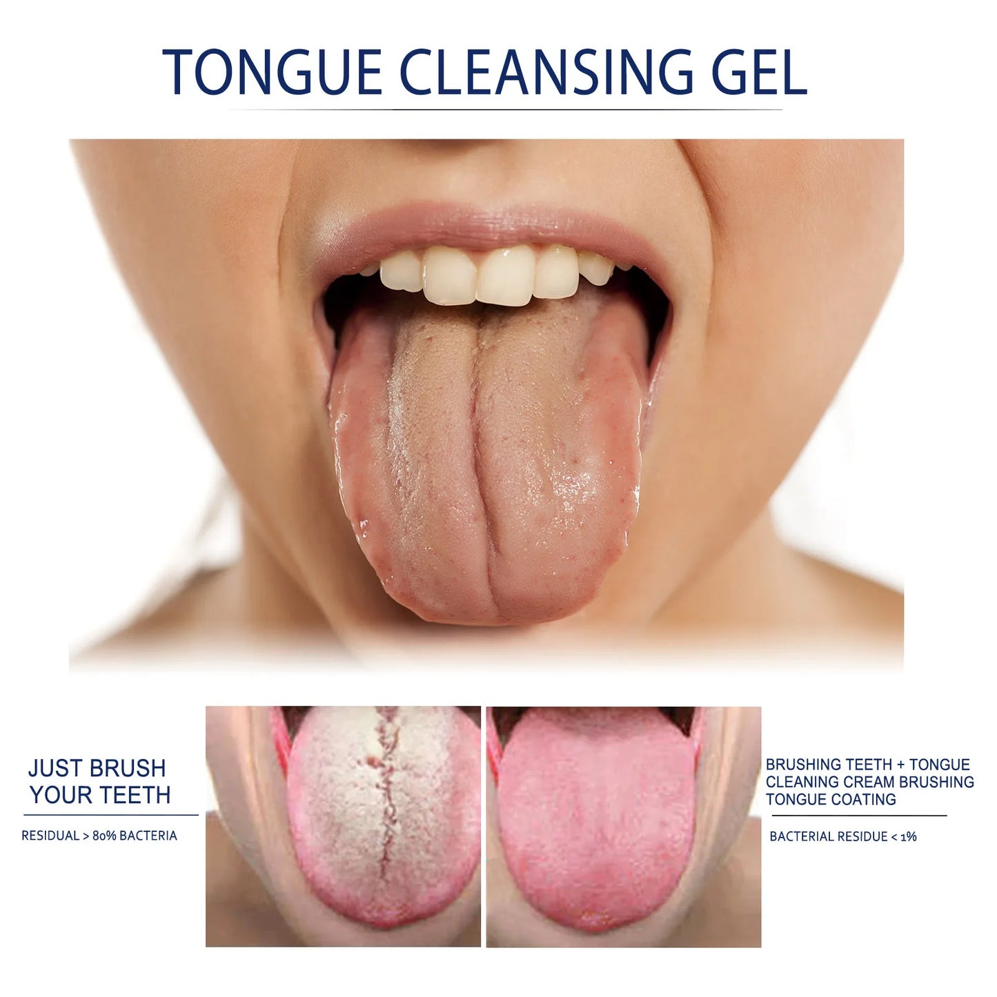 Tongue Cleansing Gel Tongue Coating Removal Kit Removing Thick White Tongue Coating,Balance Flora Freshing Breath Oral Care Tool by Anti Spier