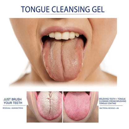 Tongue Cleansing Gel Tongue Coating Removal Kit Removing Thick White Tongue Coating,Balance Flora Freshing Breath Oral Care Tool by Anti Spier