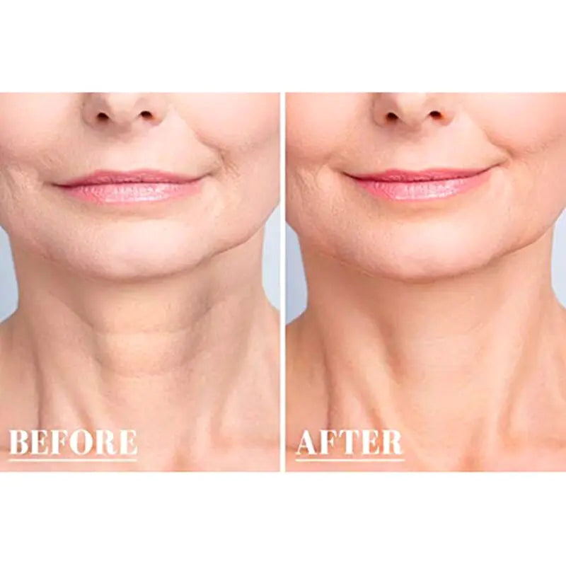 Reusable Anti Wrinkle Chest by Anti Spier