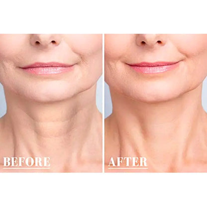 Reusable Anti Wrinkle Chest by Anti Spier