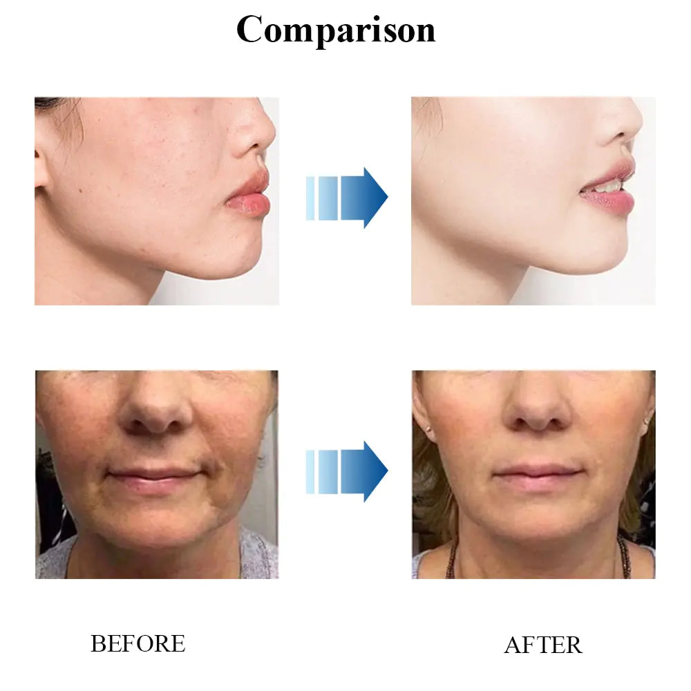 Anti Aging Face Cream by Anti Spier