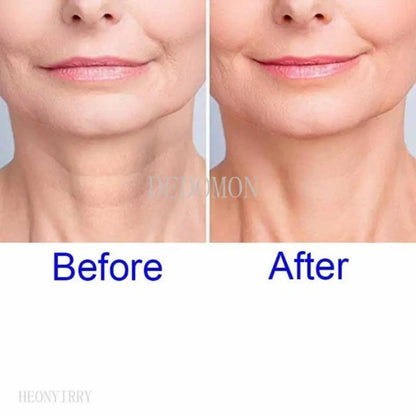 Silicone Anti-Wrinkle Pad by Anti Spier