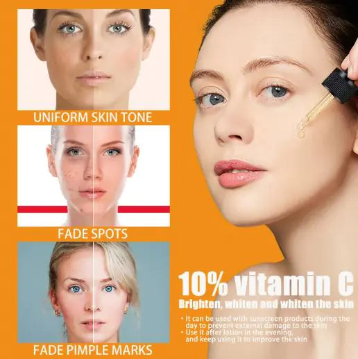 Vitamin C Serums by Anti Spier