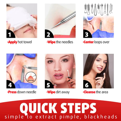 Cbiumpro Blackhead Remover Tools, Pimple Popper Tool Kit, Blackhead Extractor Tool, Zit Popper Tool, Professional Pimple Extractor Tool for Blackhead, Acne, Whitehead, Comedone on Nose - with Case Pimple Popper Tools 6 Pack - Cool Black by Anti Spier