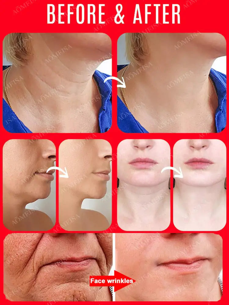 Eelhoe™ Anti-wrinkle anti-aging essence firming skin facial by Anti Spier