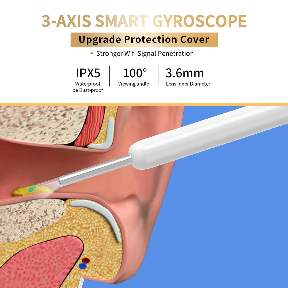 Ear Wax Removal Tool With Camera by Anti Spier