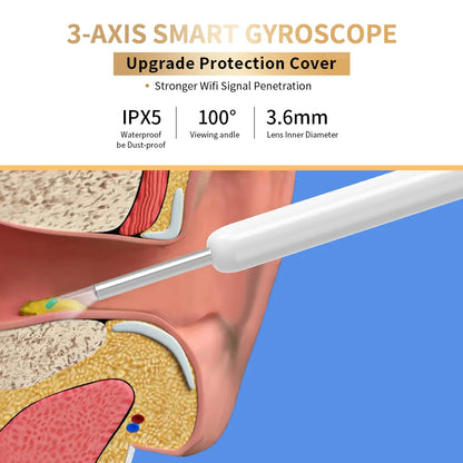 Ear Wax Removal Tool With Camera by Anti Spier