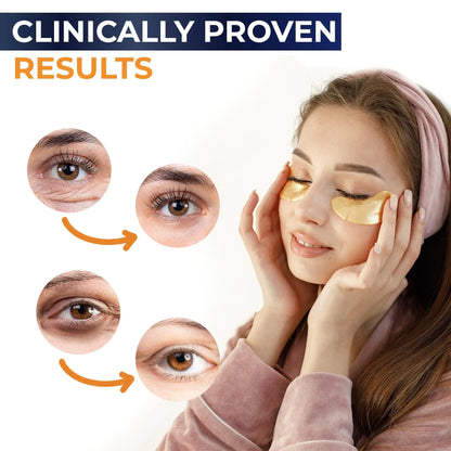 Under Eye Patches For Puffy Eyes And Dark Circles 30 Pair Eye Masks Anti Aging by Anti Spier