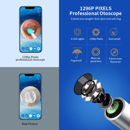 Ear Wax Removal Tool With Camera by Anti Spier